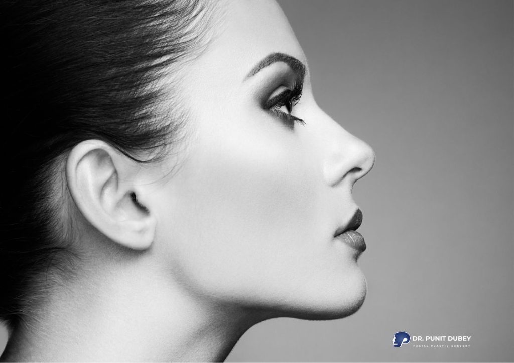 Chin Filler in Delhi by Dr. Punit Dubey