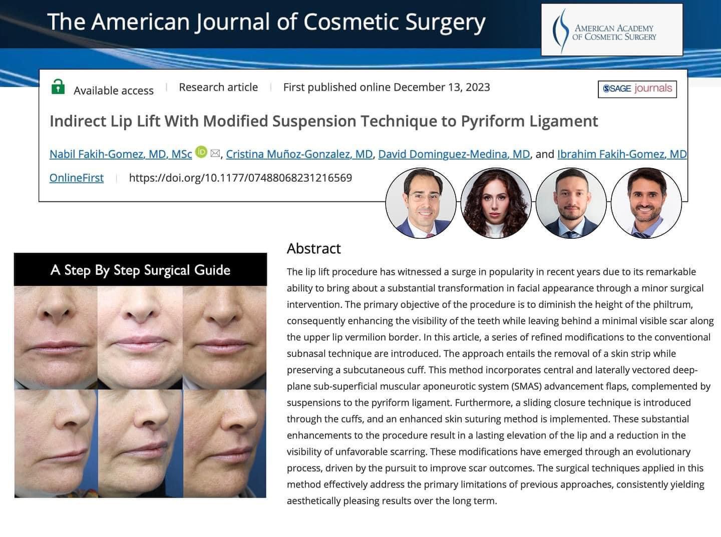 Indirect Lip Lift Surgery in India – Innovative Technique for Enhanced Lip Contouring