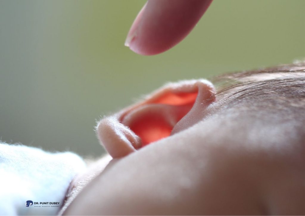 Infant Ear Molding