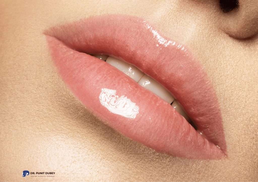 Benefits of Lip Fillers in Delhi – Fuller, Natural-Looking Lips with Minimal Downtime