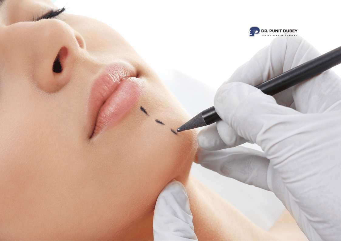 Chin Implant in Delhi with Dr. Punit Dubey-Customized Solutions for Chin Augmentation