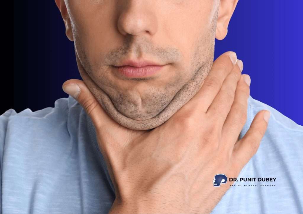 Reasons for Double Chin and Removal with Deep Neck Lift in Delhi by Dr. Punit Dubey