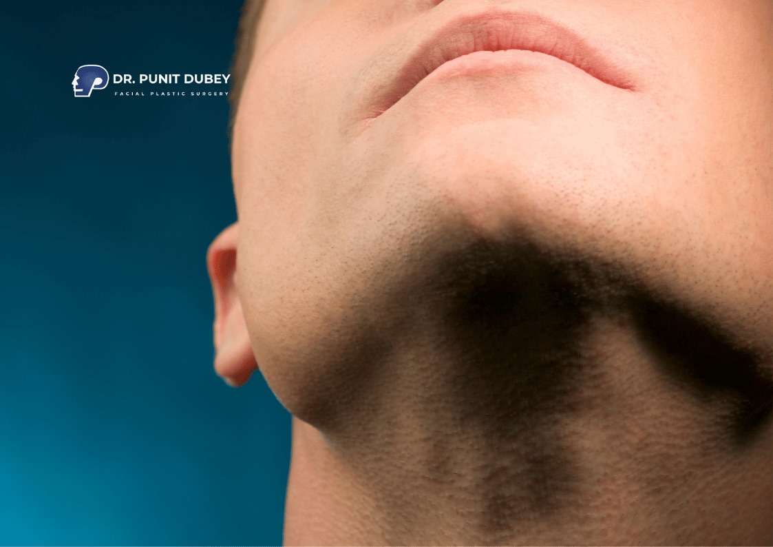 Benefits of Double Chin Removal in Delhi by Dr. Punit Dubey – Improved Jawline and Facial Contours