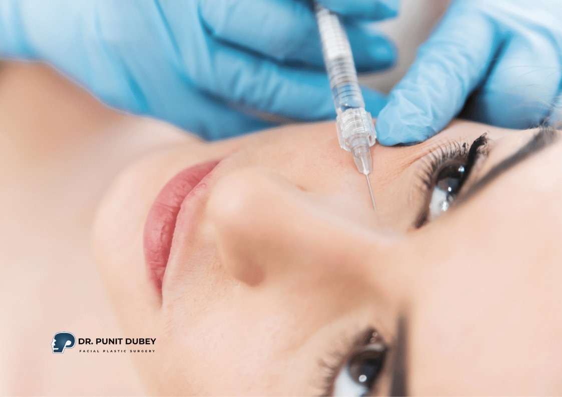 Dark Circle Fillers in Delhi by Dr. Punit Dubey – Restore Youthful Eyes Without Surgery