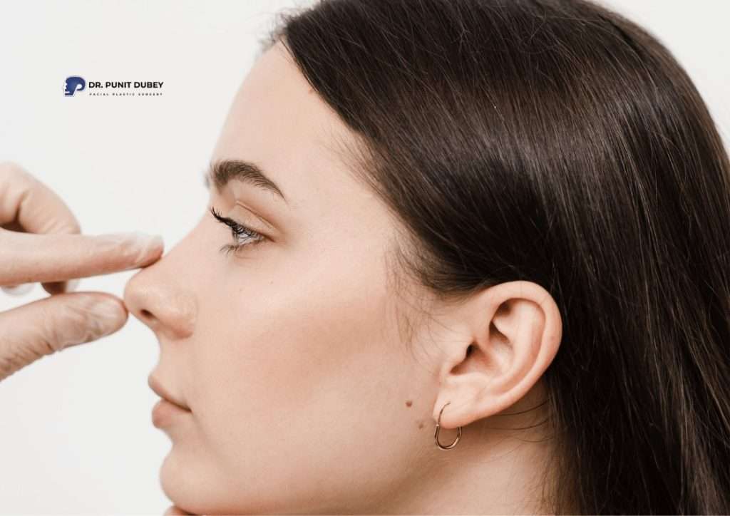 Nose anatomy explained for rhinoplasty surgery in Delhi by Dr. Punit Dubey.