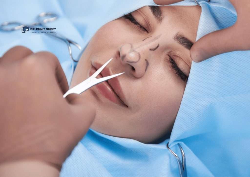 Rhinoplasty cost in Delhi – Affordable nose reshaping surgery by Dr. Punit Dubey.