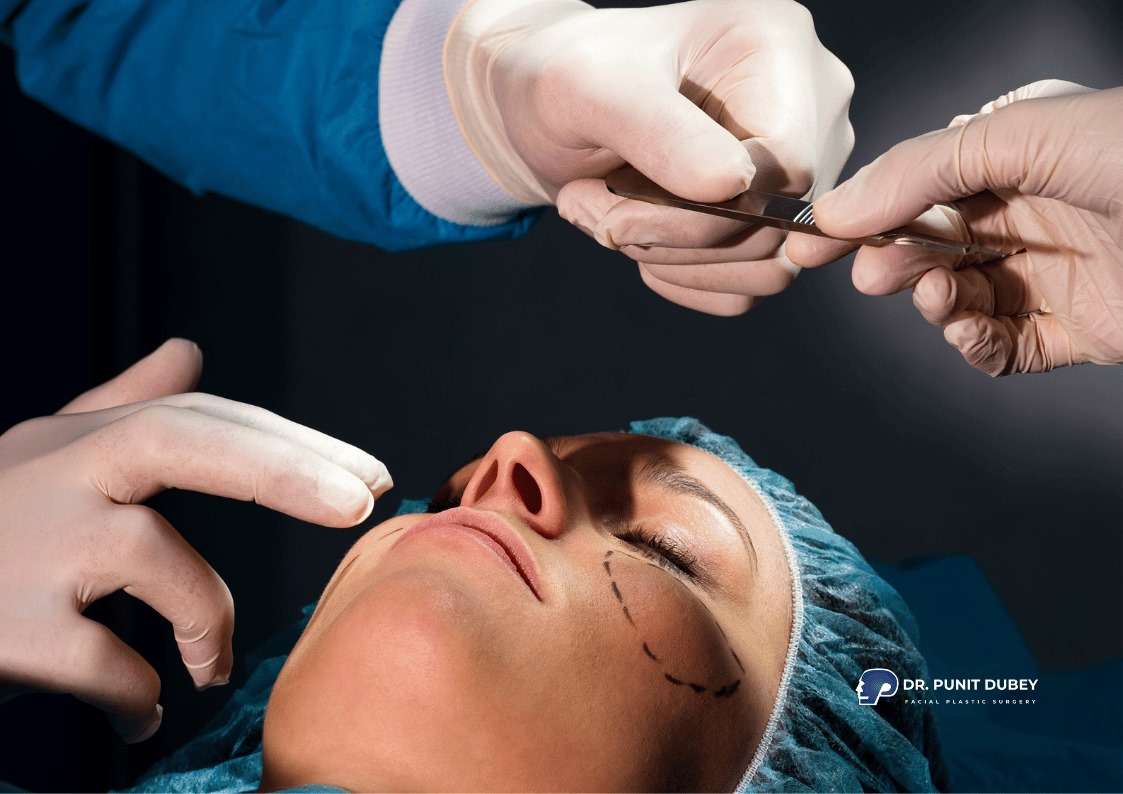 Process of Midface Lift Surgery in India with Dr. Punit Dubey – step-by-step facial rejuvenation.