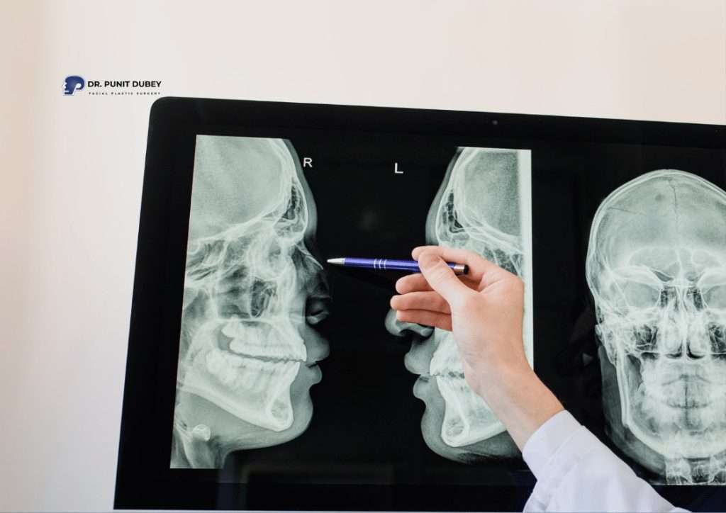 CT scan and X-ray for facial fracture in Delhi – advanced imaging for precise surgical planning.