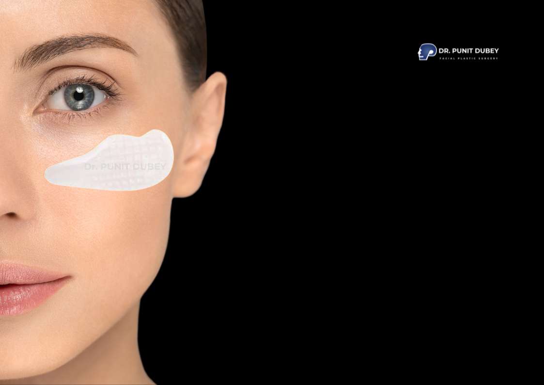 Expert cheek implant Surgery in India by Dr. Punit Dubey – customized facial rejuvenation for enhanced midface volume.
