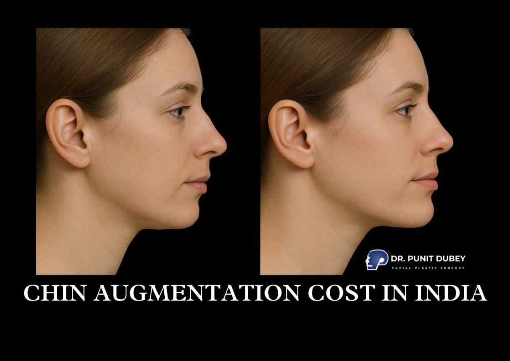 Chin augmentation cost in India – affordable pricing for chin filler, chin implant and genioplasty procedures.