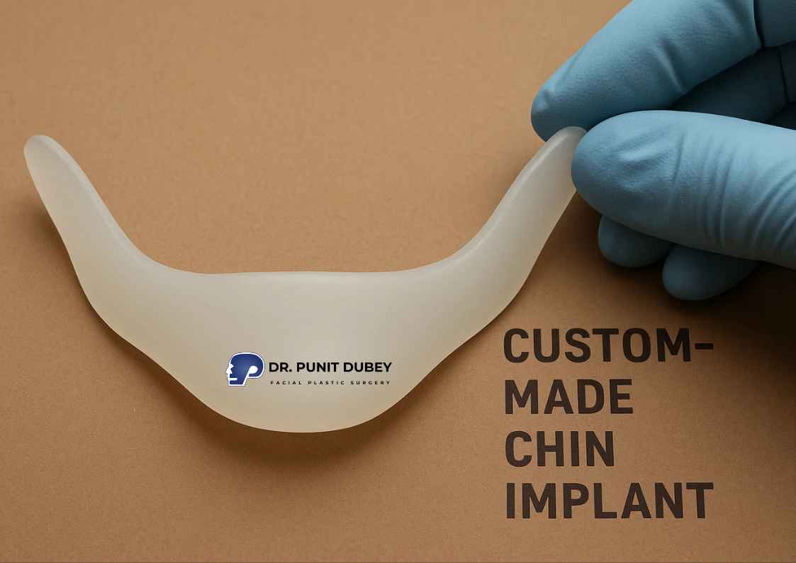 Chin Augmentation Surgery in India – Define Your Profile with custom chin implant.