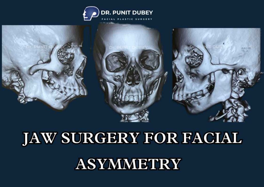 Facial Asymmetry Correction Cost in India – Customized Treatment with Dr. Punit Dubey.