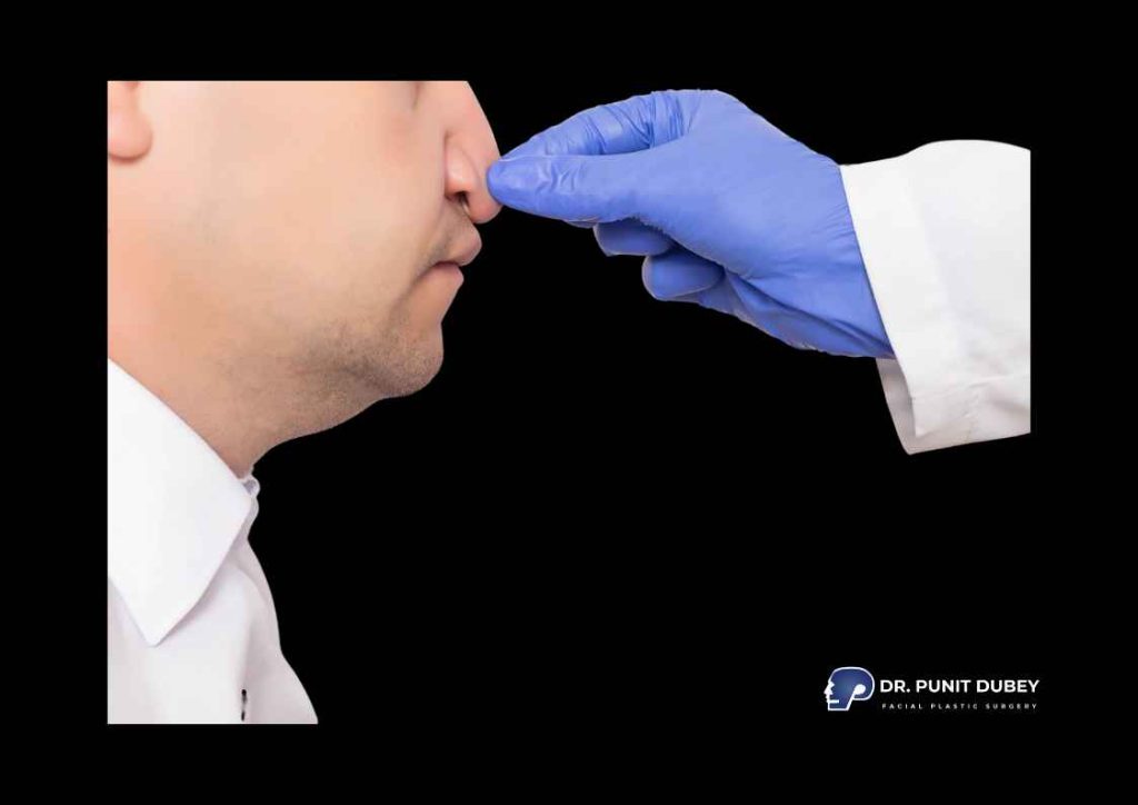 Expert Septoplasty Surgery in Delhi – Functional Nasal Surgery by Dr. Punit Dubey.