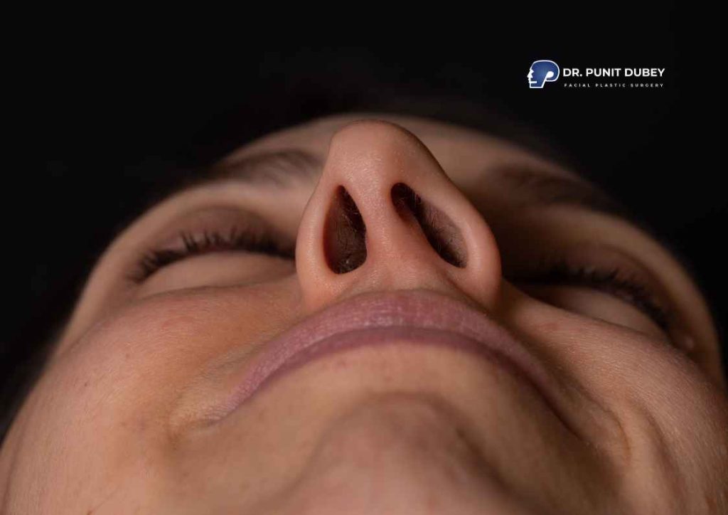 What is septoplasty surgery – deviated septum correction explained.