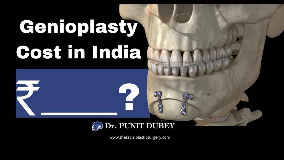 Genioplasty Cost in Delhi – Chin Surgery Price Guide (2025) by Dr. Punit Dubey.