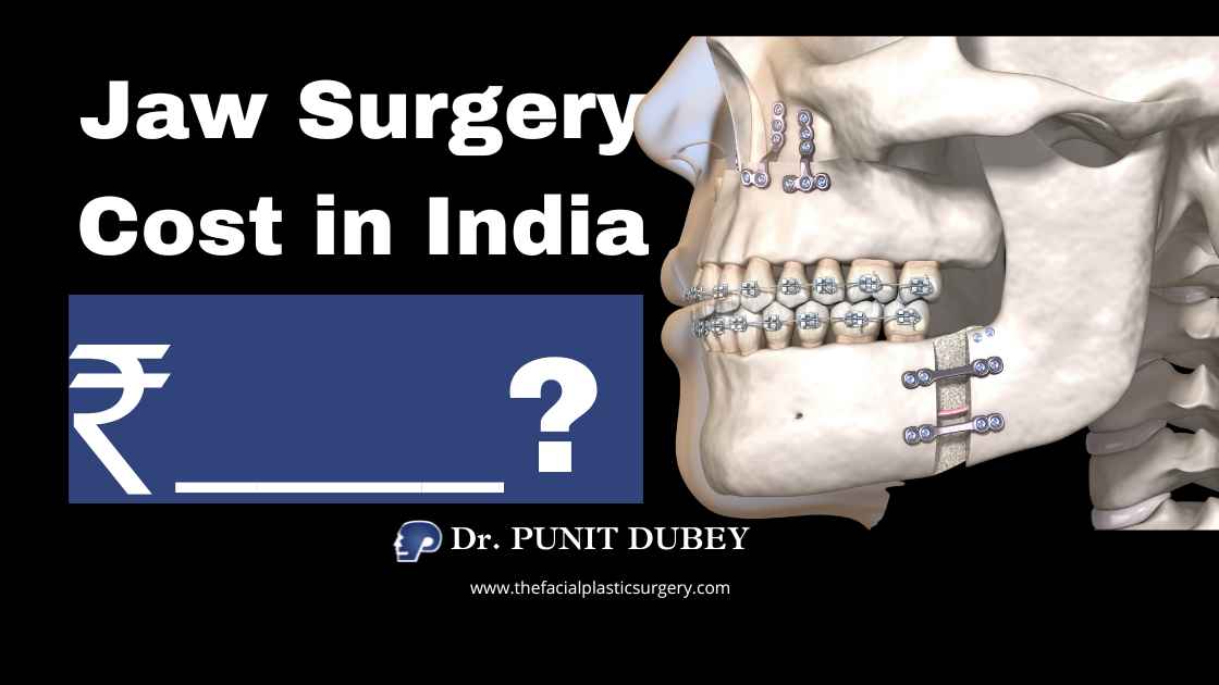 Jaw Surgery Cost in Delhi (2025) Orthognathic Surgery in Delhi & Double Jaw Surgery in India by Dr. Punit Dubey