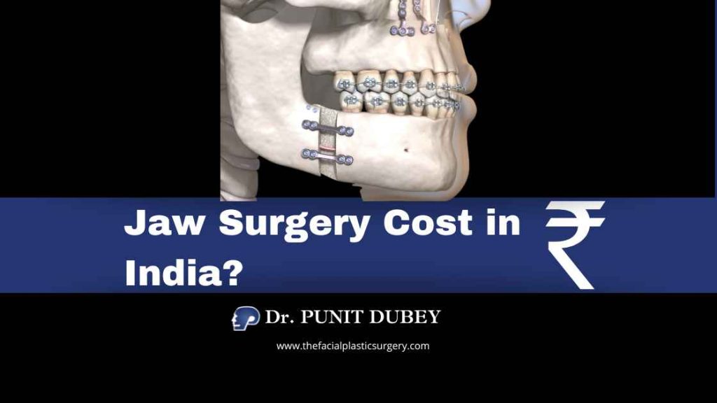 Jaw Surgery Cost in Delhi (2025) – Reshape Your Facial Profile with Corrective Jaw Surgery in India by Dr. Punit Dubey