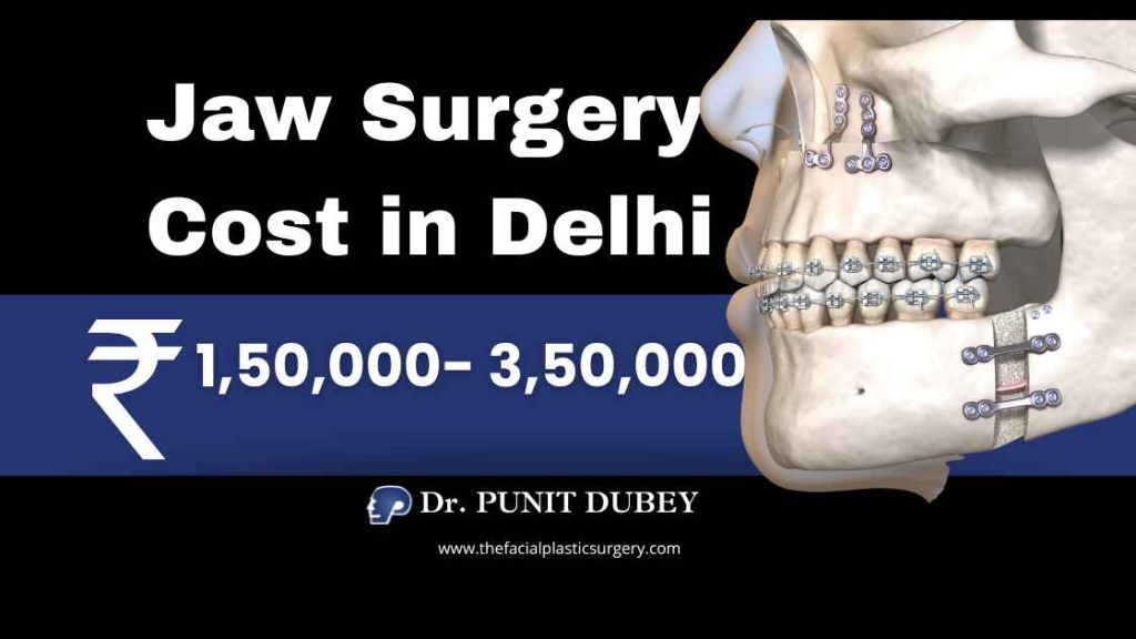 Jaw surgery cost in India by Dr. Punit Dubey – Orthognathic Surgery in India