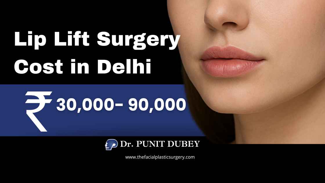 Lip Lift Surgery Cost in India – 2026. Lip Lift in Delhi by Dr. Punit Dubey