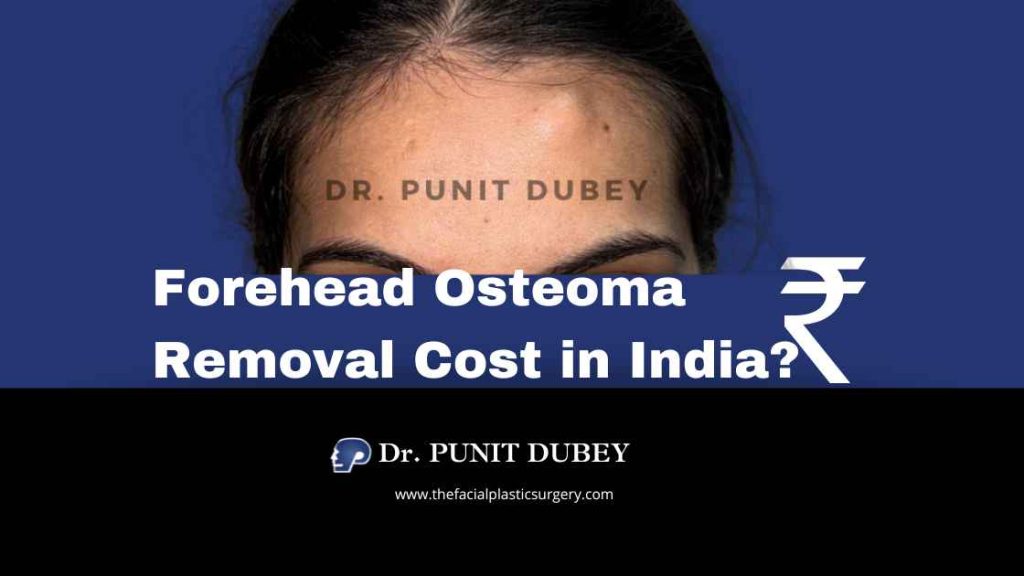 Osteoma Forehead Removal Cost in Delhi (2025) – Surgical & Endoscopic Options by Dr. Punit Dubey