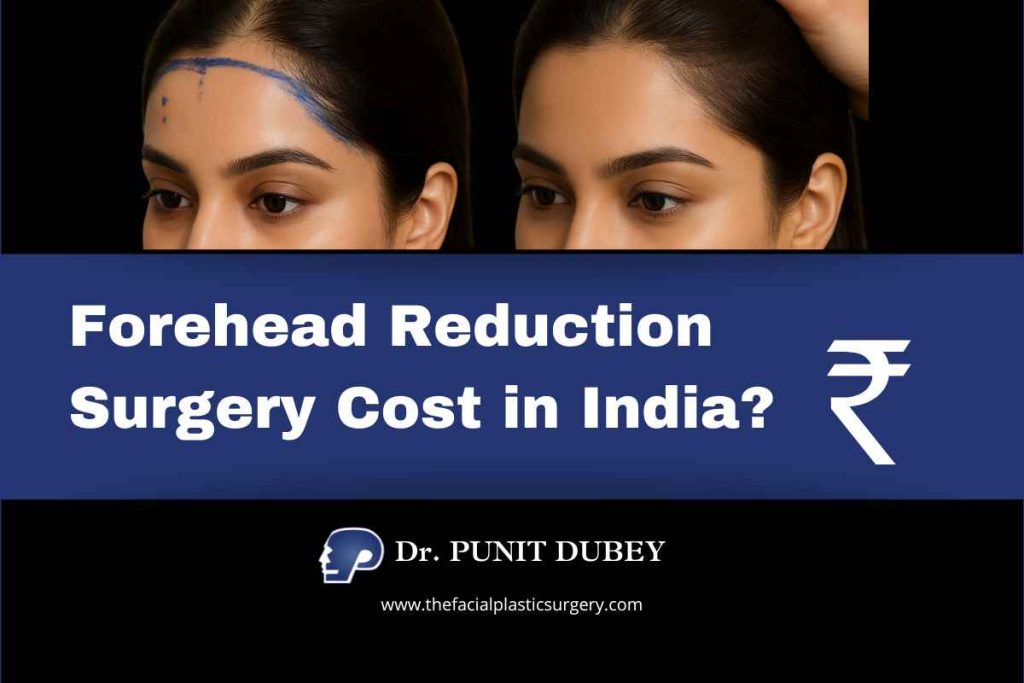 Forehead Reduction Surgery Cost in Delhi 2025. Forehead Reduction Surgery in India by Dr. Punit Dubey