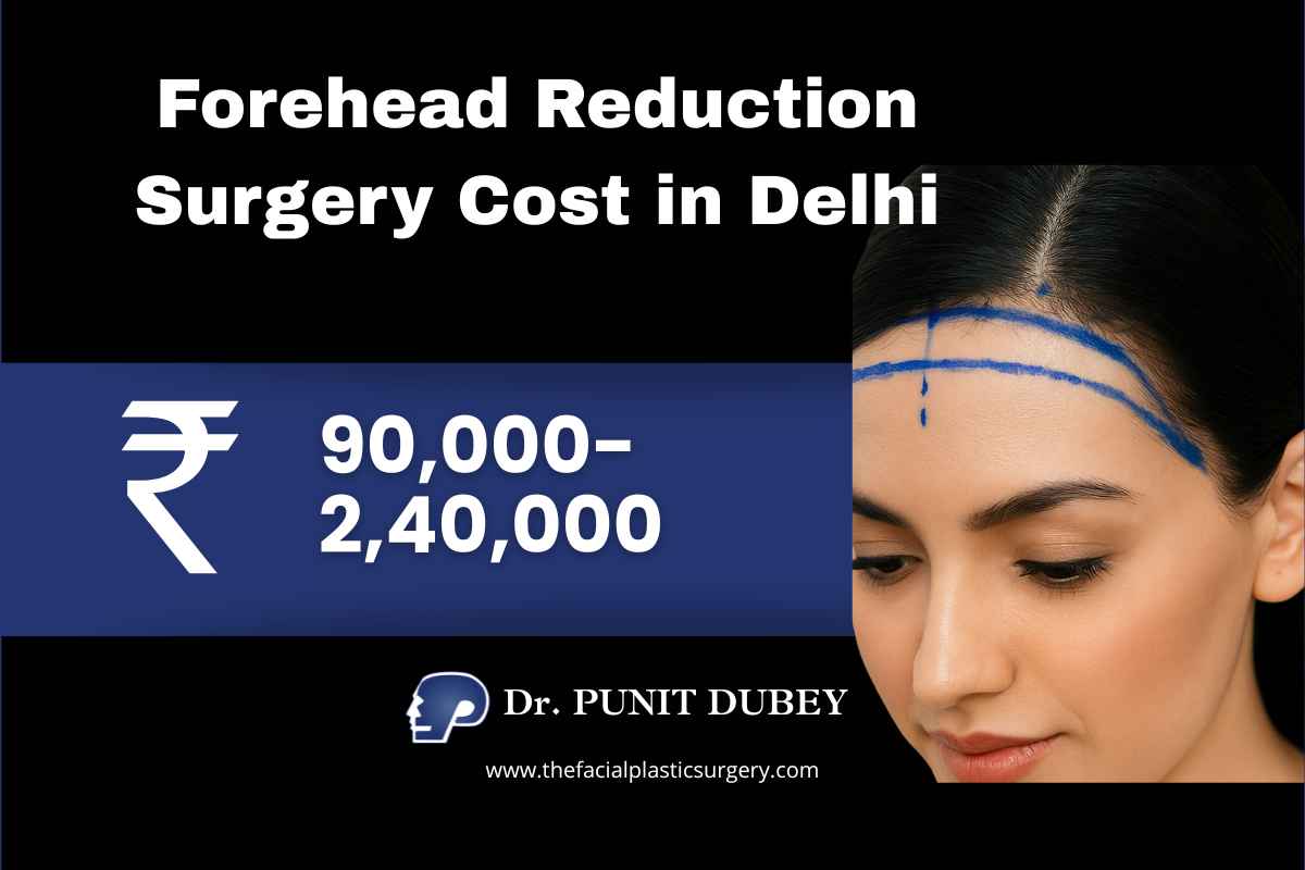 Forehead reduction surgery cost in India 2026. Hairline Lowering Surgery in Delhi by Dr. Punit Dubey