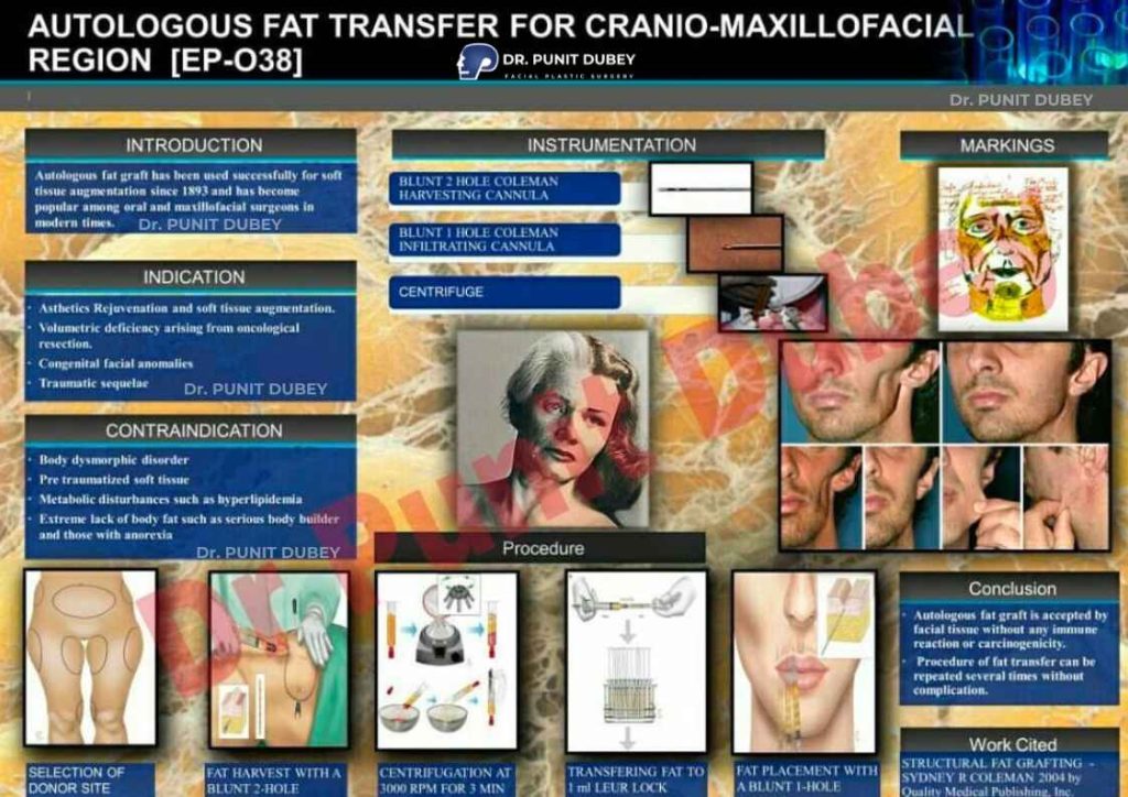 Nano Fat Grafting Procedure in India - A Natural Solution for Facial Rejuvenation